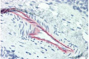 Human Thymus, Vessel (formalin-fixed, paraffin-embedded) stained with HSPG2 antibody ABIN337194 at 5 ug/ml followed by biotinylated anti-mouse IgG secondary antibody ABIN481714, alkaline phosphatase-streptavidin and chromogen.