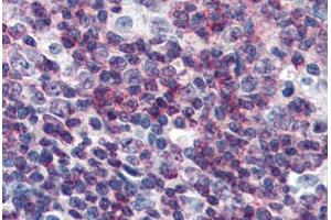 Human Tonsil (formalin-fixed, paraffin-embedded) stained with CEBPB antibody ABIN364320 at 10 ug/ml followed by biotinylated anti-mouse IgG secondary antibody ABIN481714, alkaline phosphatase-streptavidin and chromogen. (CEBPB anticorps)
