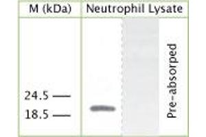 WB on human neutrophil lysate using Rabbit antibody to internal part of human Cathelicidin antimicrobial peptide (CAP-18): IgG (ABIN350180) at 50 µg/ml concentration. (Cathelicidin anticorps  (AA 40-80))