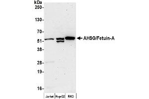 Western Blotting (WB) image for anti-alpha-2-HS-Glycoprotein (AHSG) (AA 25-75) antibody (ABIN7449953)