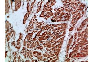 Immunohistochemical analysis of paraffin-embedded human-heart, antibody was diluted at 1:200