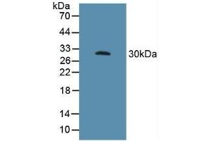 Detection of FcgR3A in Porcine Spleen Tissue using Polyclonal Antibody to Fc Fragment Of IgG Low Affinity IIIa Receptor (FcgR3A)