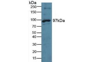 Detection of TTK in Human Hela Cells using Polyclonal Antibody to TTK Protein Kinase (TTK)