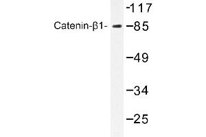 Image no. 1 for anti-Catenin (Cadherin-Associated Protein), beta 1, 88kDa (CTNNB1) antibody (ABIN272182) (CTNNB1 anticorps)