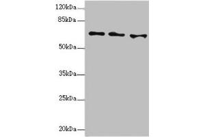 Western blot All lanes: EYA3 antibody at 1. (EYA3 anticorps  (AA 1-300))