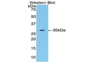 Western Blotting (WB) image for anti-Acrosin (ACR) (AA 43-291) antibody (ABIN1857876)