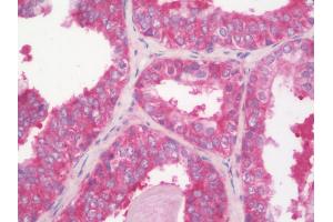 Anti-SLC16A13 antibody IHC staining of human prostate.