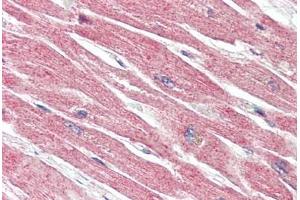 Human Heart (formalin-fixed, paraffin-embedded) stained with BECN1 antibody ABIN461895 at 5 ug/ml followed by biotinylated goat anti-rabbit IgG secondary antibody ABIN481713, alkaline phosphatase-streptavidin and chromogen. (Beclin 1 anticorps  (N-Term))