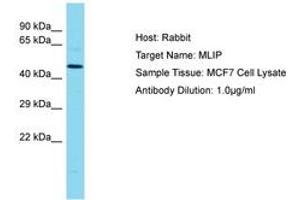 Image no. 1 for anti-Muscular LMNA-Interacting Protein (MLIP) (AA 194-243) antibody (ABIN6750721) (MLIP anticorps  (AA 194-243))