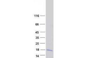 Validation with Western Blot