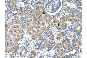 SSR1 antibody was used for immunohistochemistry at a concentration of 4-8 ug/ml.