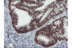 Image no. 5 for anti-Fragile X Mental Retardation 1 (FMR1) (AA 36-279) antibody (ABIN1491454)