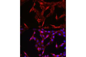 Immunofluorescence analysis of NIH/3T3 cells using ST Rabbit pAb (ABIN6128541, ABIN6148581, ABIN6148582 and ABIN6213980) at dilution of 1:200 (40x lens).