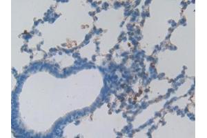 Detection of HSPBP1 in Rat Lung Tissue using Polyclonal Antibody to Heat Shock 70 kDa Binding Protein 1 (HSPBP1)