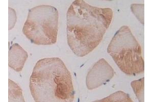 Detection of NOS2 in Rat Skeletal muscle Tissue using Polyclonal Antibody to Nitric Oxide Synthase 2, Inducible (NOS2)