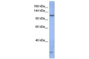 WB Suggested Anti-PIWIL1 Antibody Titration:  0. (PIWIL1 anticorps  (N-Term))