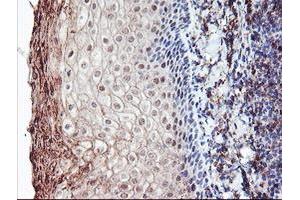 Image no. 5 for anti-Retinaldehyde Binding Protein 1 (RLBP1) antibody (ABIN1497622) (RLBP1 anticorps)