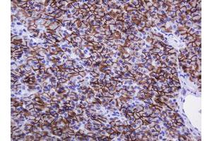 Image no. 4 for anti-Carbonic Anhydrase 12 (CA12) antibody (ABIN1497067)