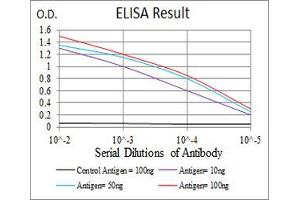 Black line: Control Antigen (100 ng), Purple line: Antigen(10 ng), Blue line: Antigen (50 ng), Red line: Antigen (100 ng),