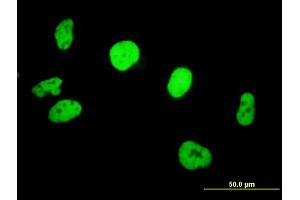 Immunofluorescence of purified MaxPab antibody to SMARCB1 on HeLa cell. (SMARCB1 anticorps  (AA 1-385))