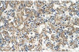 Immunohistochemical staining (Formalin-fixed paraffin-embedded sections) of human liver with GOT2 polyclonal antibody  at 4-8 ug/mL working concentration. (GOT2 anticorps  (C-Term))