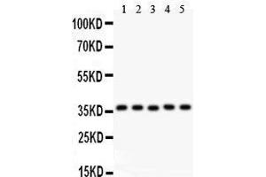 Anti- KLF6 antibody, Western blotting All lanes: Anti KLF6  at 0.