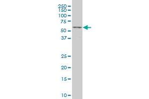 TCF7L2 monoclonal antibody (M06), clone 3A4 Western Blot analysis of TCF7L2 expression in K-562 .