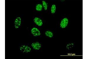 Immunofluorescence of purified MaxPab antibody to ELK4 on HeLa cell. (ELK4 anticorps  (AA 1-405))