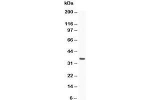 Western blot testing of Caspase-3 antibody and recombinant human protein (0.