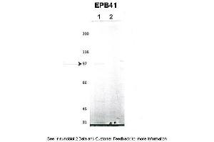 Lanes:   1. (EPB41 anticorps  (N-Term))