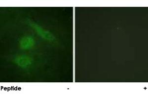 Immunofluorescence analysis of HeLa cells, using IRF3 polyclonal antibody . (IRF3 anticorps)