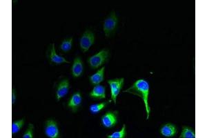 Immunofluorescent analysis of A549 cells using ABIN7164574 at dilution of 1:100 and Alexa Fluor 488-congugated AffiniPure Goat Anti-Rabbit IgG(H+L) (ZDHHC2 anticorps  (AA 75-130))