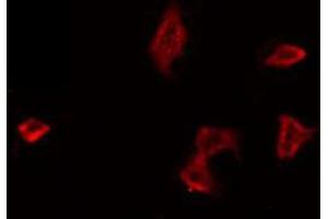 ABIN6266644 staining HeLa by IF/ICC. (PAR1 anticorps  (N-Term))