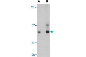 Western blot analysis of PAFAH1B1 in HeLa cell lysate with PAFAH1B1 polyclonal antibody  at (A) 0. (PAFAH1B1 anticorps  (C-Term))