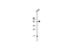Anti-FUT6 Antibody (Center) at 1:1000 dilution + Hela whole cell lysate Lysates/proteins at 20 μg per lane.