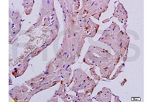 Formalin-fixed and paraffin embedded mouse heart tissue labeled with Anti-Desmin Polyclonal Antibody, Unconjugated (ABIN736566) at 1:200, followed by conjugation to the secondary antibody and DAB staining