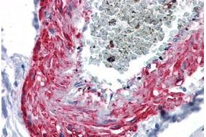 Human Vessel: Formalin-Fixed, Paraffin-Embedded (FFPE) (MYOC anticorps  (AA 36-135))
