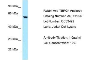 Western Blotting (WB) image for anti-Transforming Growth Factor beta Regulator 4 (TBRG4) (N-Term) antibody (ABIN2789299)