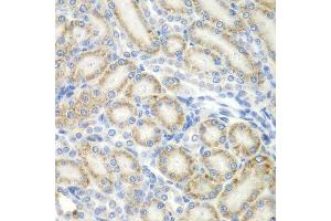 Immunohistochemistry of paraffin-embedded rat kidney using ASPSCR1 antibody.