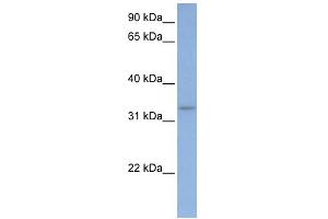 WB Suggested Anti-DAZL Antibody Titration:  0. (DAZL anticorps  (C-Term))