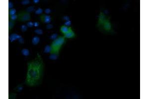 Image no. 3 for anti-Phosphoinositide-3-Kinase, Regulatory Subunit 5 (PIK3R5) antibody (ABIN1500214) (PIK3R5 anticorps)