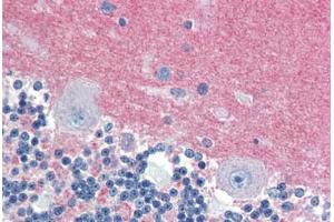 Human Brain, Cerebellum (formalin-fixed, paraffin-embedded) stained with RAB3A antibody ABIN462094 at 10 ug/ml followed by biotinylated goat anti-rabbit IgG secondary antibody ABIN481713, alkaline phosphatase-streptavidin and chromogen.
