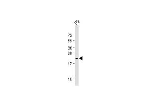 Anti-VHL Antibody (N-term) at 1:2000 dilution + F9 whole cell lysate Lysates/proteins at 20 μg per lane.