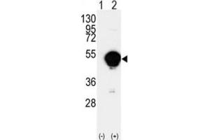 Western Blotting (WB) image for anti-Cytochrome P450, Family 20, Subfamily A, Polypeptide 1 (CYP20A1) antibody (ABIN3003220) (CYP20A1 anticorps)