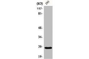 Western Blot analysis of 293 cells using Bak Polyclonal Antibody