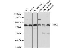 Western blot analysis of extracts of various cell lines, using ITFG1 antibody (ABIN7267919) at 1:1000 dilution. (ITFG1 anticorps  (AA 313-612))
