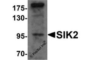 Western Blotting (WB) image for anti-Salt-Inducible Kinase 2 (SIK2) (Middle Region) antibody (ABIN1031093)