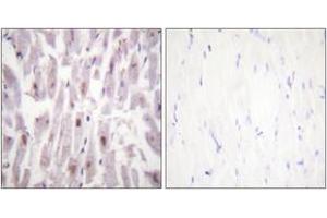 Immunohistochemistry analysis of paraffin-embedded human heart, using PPAR-BP (Phospho-Thr1457) Antibody. (PPAR-BP (AA 1423-1472), (pThr1457) anticorps)