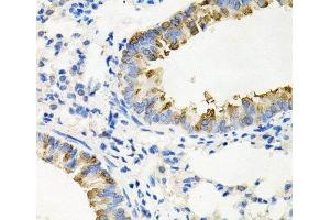 Immunohistochemistry of paraffin-embedded Mouse lung using IRAK2 Polyclonal Antibody at dilution of 1:100 (40x lens). (IRAK2 anticorps)