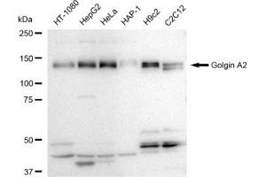 Western blotting analysis using Golgin A2 antibody (ABIN7798797).